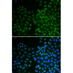 Nuclear Receptor Subfamily 0 Group B Member 2 (NR0B2) Antibody