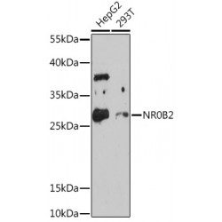 Nuclear Receptor Subfamily 0 Group B Member 2 (NR0B2) Antibody