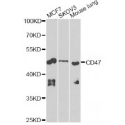 Western blot analysis of extracts of various cell lines, using CD47 Antibody (abx001519) at 1/1000 dilution.