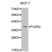 Western blot analysis of extracts of MCF-7 cells, using FCER2 antibody (abx001520) at 1/1000 dilution.