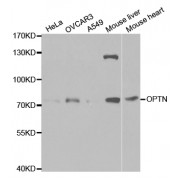 Western blot analysis of extracts of various cell lines, using OPTN antibody (abx001525) at 1/1000 dilution.
