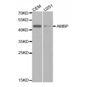 Western blot analysis of extracts of various cell lines, using AMBP antibody (abx001526) at 1/1000 dilution.