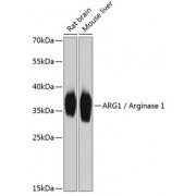 Western blot analysis of extracts of various cell lines, using ARG1 Antibody (abx001527) at 1/2000 dilution.