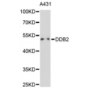 Western blot analysis of extracts of A-431 cells, using DDB2 antibody (abx001528) at 1/1000 dilution.