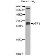 Western blot analysis of extracts of mouse lung, using ATF3 Antibody (abx001531) at 1/1000 dilution.