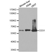Western blot analysis of extracts of various cell lines, using CES1 antibody (abx001532) at 1/1000 dilution.