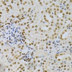 H/ACA Ribonucleoprotein Complex Subunit DKC1 (DKC1) Antibody