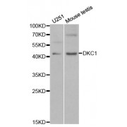 Western blot analysis of extracts of various cell lines, using DKC1 antibody (abx001537) at 1/1000 dilution.