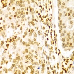 H/ACA Ribonucleoprotein Complex Subunit DKC1 (DKC1) Antibody