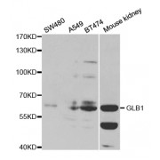 Western blot analysis of extracts of various cell lines, using GLB1 antibody (abx001538) at 1/1000 dilution.