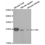 Western blot analysis of extracts of various cell lines, using LY96 antibody (abx001540) at 1/1000 dilution.