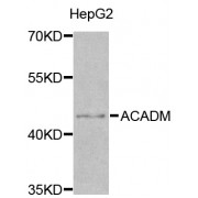Western blot analysis of extracts of HepG2 cells, using ACADM antibody (abx001542) at 1/1000 dilution.