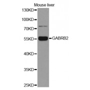 Western blot analysis of extracts of mouse liver, using GABRB2 antibody (abx001543) at 1/1000 dilution.