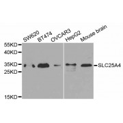 Western blot analysis of extracts of various cell lines, using SLC25A4 antibody (abx001546).