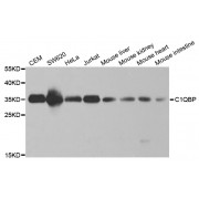 Western blot analysis of extracts of various cell lines, using C1QBP antibody (abx001547) at 1/1000 dilution.