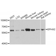 Western blot analysis of extracts of various cell lines, using EPHX2 antibody (abx001548) at 1/1000 dilution.