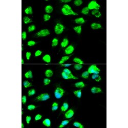 DNA Ligase 3 (LIG3) Antibody