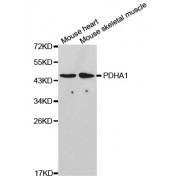 Western blot analysis of extracts of various cell lines, using PDHA1 antibody (abx001554) at 1/1000 dilution.