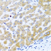 Immunohistochemistry of paraffin-embedded human liver using CCL21 antibody (abx001555) at dilution of 1/100 (40x lens).