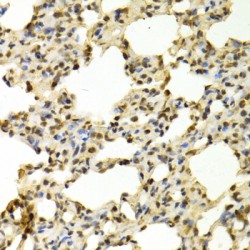 Peptidyl Arginine Deiminase Type IV (PADI4) Antibody