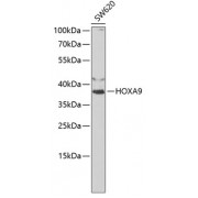 Western blot analysis of extracts of SW620 cells, using HOXA9 antibody (abx001561) at 1/1000 dilution.