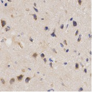 Immunohistochemistry of paraffin-embedded rat brain using PPP2R4 Antibody (abx001563) at dilution of 1/200 (40x lens).