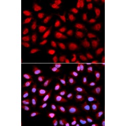 Protein Phosphatase 2A Activator, Regulatory Subunit 4 (PPP2R4) Antibody