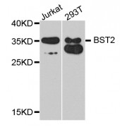 Western blot analysis of extracts of various cell lines, using BST2 antibody (abx001564) at 1/1000 dilution.