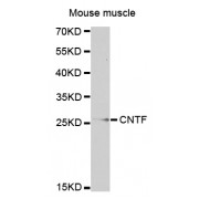 Western blot analysis of extracts of mouse muscle, using CNTF antibody (abx001565) at 1/1000 dilution.