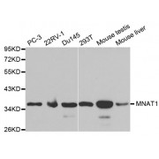 Western blot analysis of extracts of various cell lines, using MNAT1 antibody (abx001566) at 1/1000 dilution.