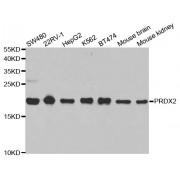 Western blot analysis of extracts of various cell lines, using PRDX2 antibody (abx001567) at 1/1000 dilution.