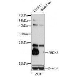 Peroxiredoxin 2 (PRDX2) Antibody