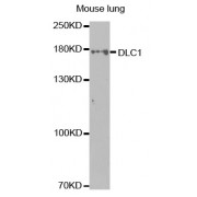 Western blot analysis of extracts of mouse lung, using DLC1 antibody (abx001569) at 1/1000 dilution.