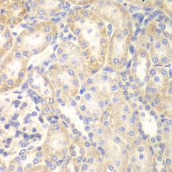 Rho GTPase-Activating Protein 7 (DLC1) Antibody