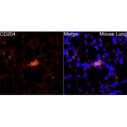 Macrophage Scavenger Receptor 1 (MSR1) Antibody