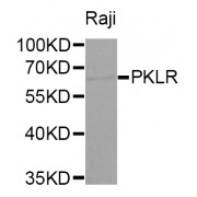 Western blot analysis of extracts of Raji cells, using PKLR antibody (abx001571) at 1/1000 dilution.
