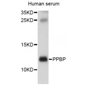 Western blot analysis of extracts of human serum, using PPBP antibody (abx001572) at 1/1000 dilution.