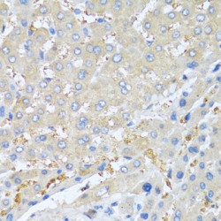 Connective Tissue Activating Peptide III (PPBP) Antibody