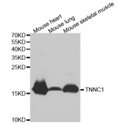 Western blot analysis of extracts of various cell lines, using TNNC1 antibody (abx001574) at 1/1000 dilution.