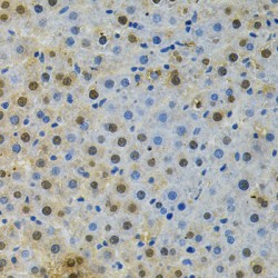 Mitotic Checkpoint Serine/threonine-Protein Kinase BUB1 (BUB1) Antibody