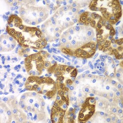 CD151 Antigen (CD151) Antibody