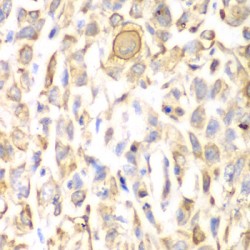 CD151 Antigen (CD151) Antibody