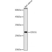 Western blot analysis of extracts of rat uterus, using CD151 Antibody (abx001576) at 1/1000 dilution.