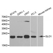 Western blot analysis of extracts of various cell lines, using GLO1 antibody (abx001578) at 1/1000 dilution.