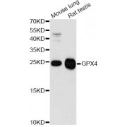Western blot analysis of extracts of various cell lines, using GPX4 antibody (abx001579) at 1/1000 dilution.