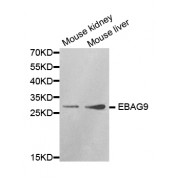 Western blot analysis of extracts of various cell lines, using EBAG9 antibody (abx001581) at 1/1000 dilution.