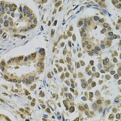 Receptor-Binding Cancer Antigen Expressed On SiSo Cells (EBAG9) Antibody
