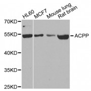 Western blot analysis of extracts of various cell lines, using ACPP antibody (abx001583) at 1/1000 dilution.