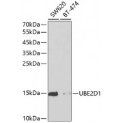 Western blot analysis of extracts of various cell lines, using UBE2D1 antibody (abx001594) at 1/1000 dilution.