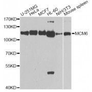 Western blot analysis of extracts of various cell lines, using MCM6 antibody (abx001595) at 1/1000 dilution.